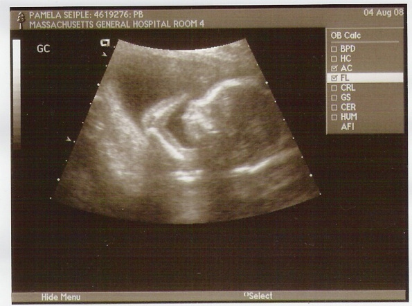 Emmett 17 weeks