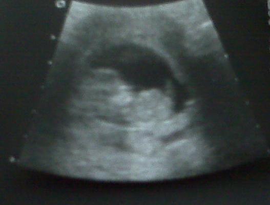 Emmett 11 weeks