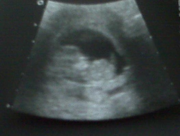 Emmett 11 weeks