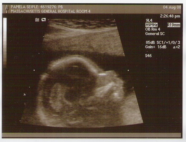 Emmett 17 weeks