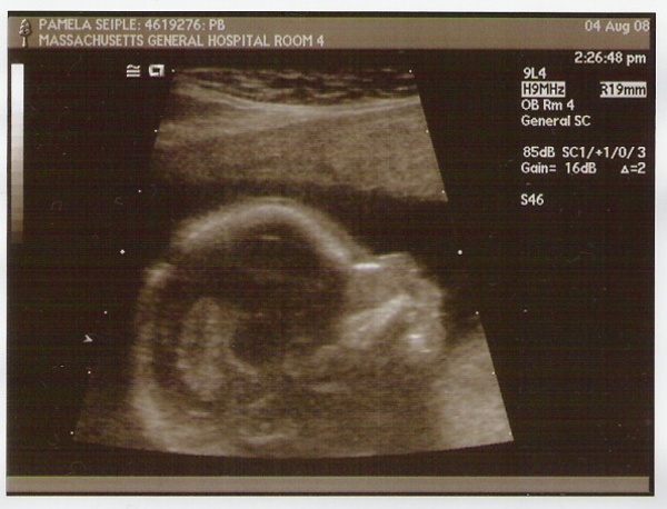 Emmett 17 weeks