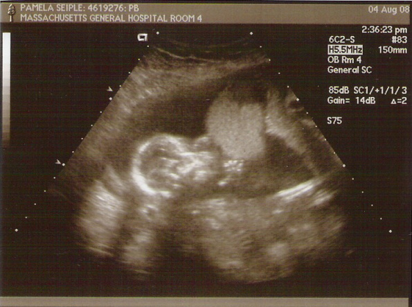 Emmett 17 weeks