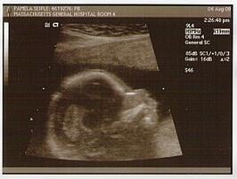 baby lump's head/brain